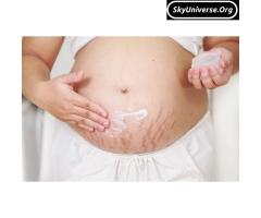 Herbal stretch marks removal cream and spray+256777422022 - 2