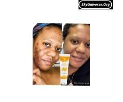 Forever living products - 2